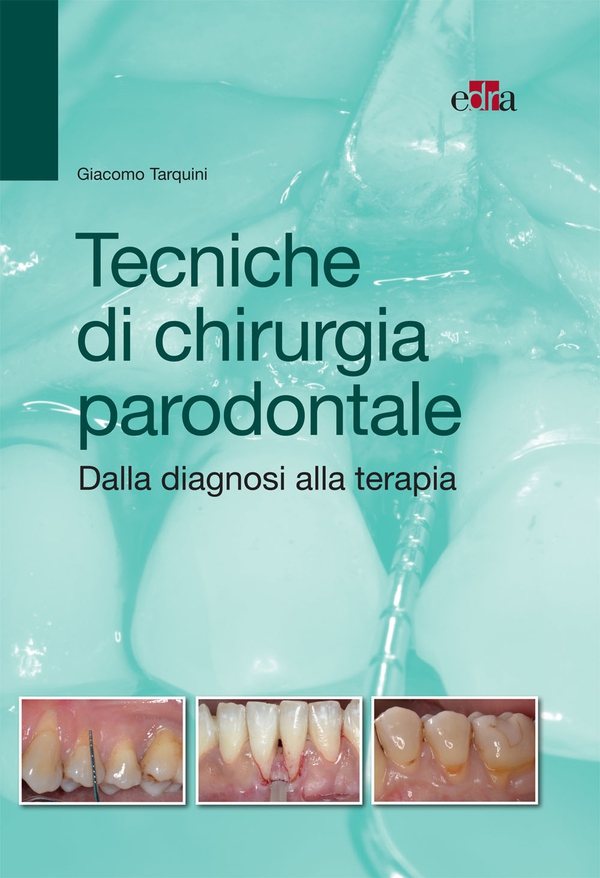 Tecniche di chirurgia parodontale - Librerie.coop Tecniche di chirurgia parodontale - Librerie.coop