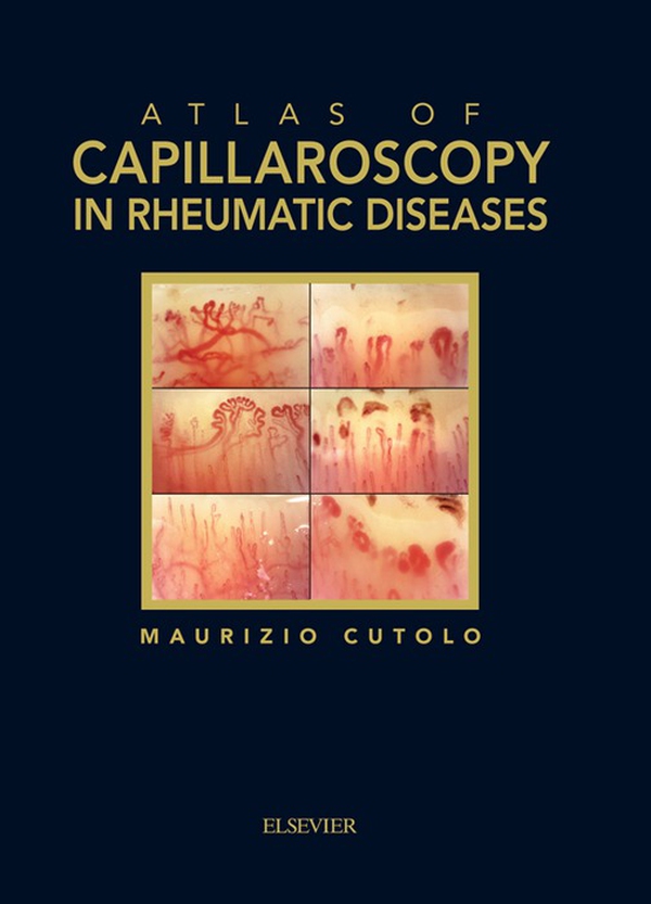 Atlas of capillaroscopy in rheumatic diseases - Librerie.coop Atlas of capillaroscopy in rheumatic diseases - Librerie.coop