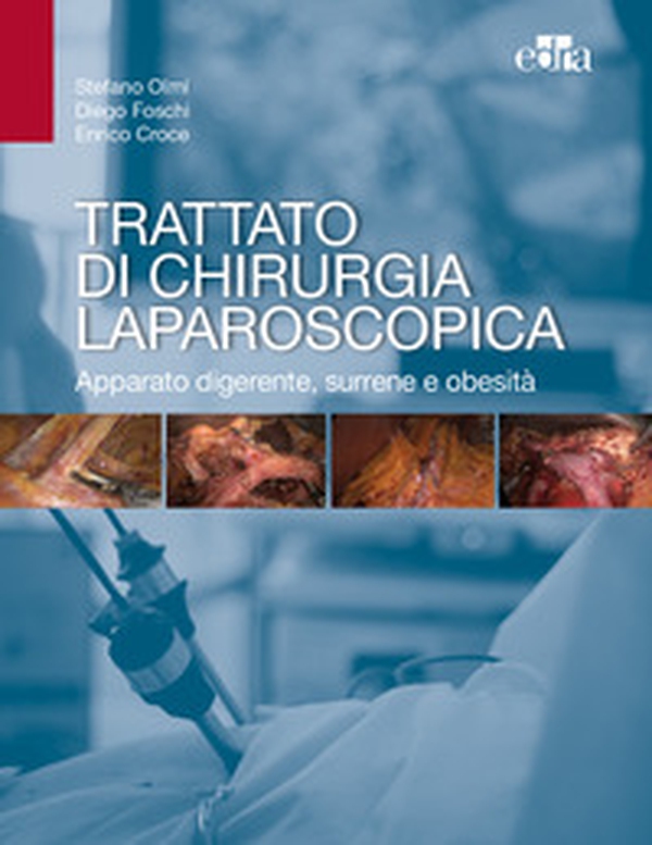 Trattato di chirurgia laparoscopica. Apparato digerente, surrene e obesità - Librerie.coop Trattato di chirurgia laparoscopica. Apparato digerente, surrene e obesità - Librerie.coop