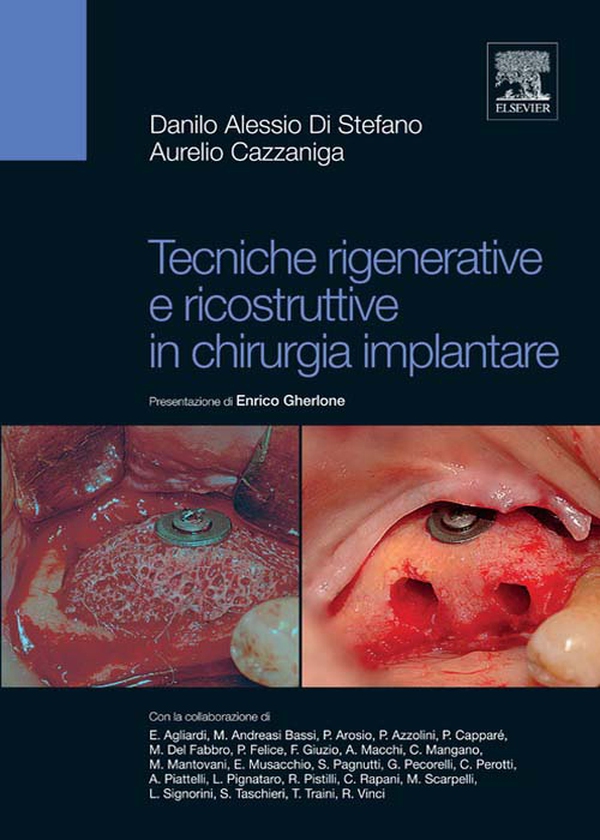 Tecniche rigenerative e ricostruttive in chirurgia implantare - Librerie.coop Tecniche rigenerative e ricostruttive in chirurgia implantare - Librerie.coop