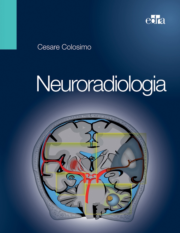 Neuroradiologia - Librerie.coop Neuroradiologia - Librerie.coop