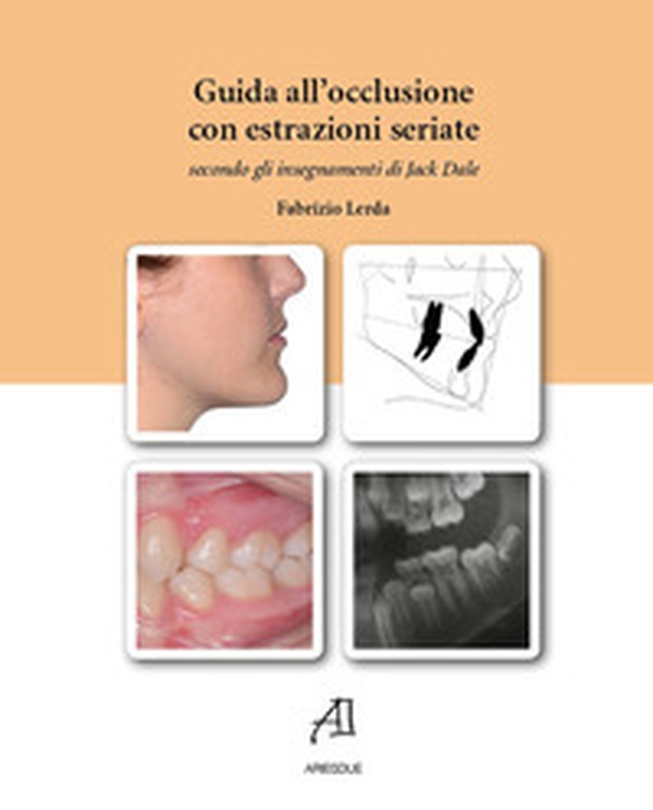 Guida all'occlusione con estrazioni seriate secondo gli insegnamenti di Jack Dale - Librerie.coop Guida all'occlusione con estrazioni seriate secondo gli insegnamenti di Jack Dale - Librerie.coop