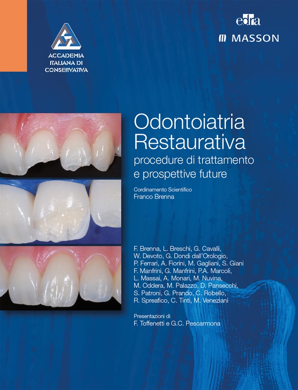 Odontoiatria restaurativa: Procedure di trattamento e prospettive future - Librerie.coop Odontoiatria restaurativa: Procedure di trattamento e prospettive future - Librerie.coop