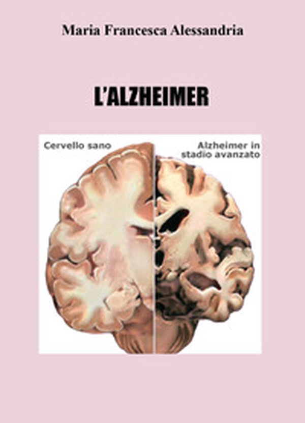 L'azheimer - Librerie.coop L'azheimer - Librerie.coop