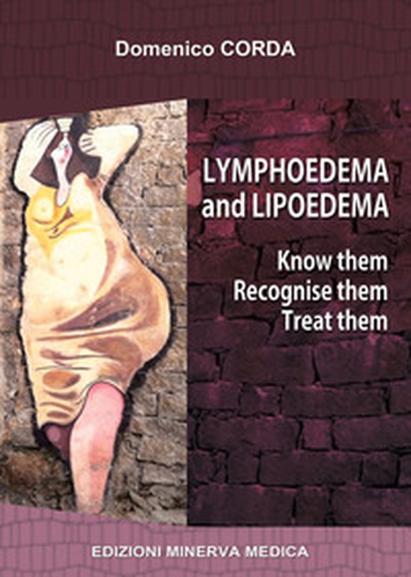 Lymphoedema and lipoedema. Know them. Recognise them. Treat them - Librerie.coop Lymphoedema and lipoedema. Know them. Recognise them. Treat them - Librerie.coop