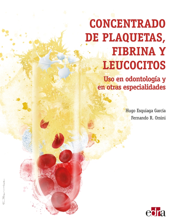 Concentrado de plaquetas, fibrina y leucocitos. Uso en odontología y en otras especialidades - Librerie.coop Concentrado de plaquetas, fibrina y leucocitos. Uso en odontología y en otras especialidades - Librerie.coop