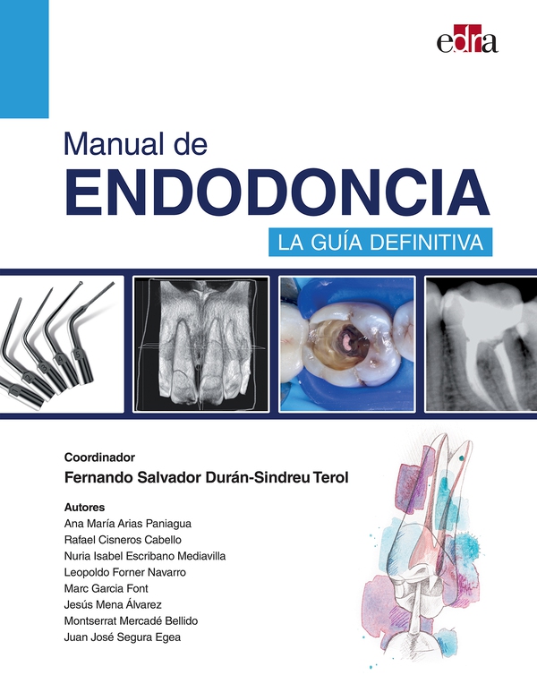 Manual de endodoncia. La guía definitiva - Librerie.coop Manual de endodoncia. La guía definitiva - Librerie.coop
