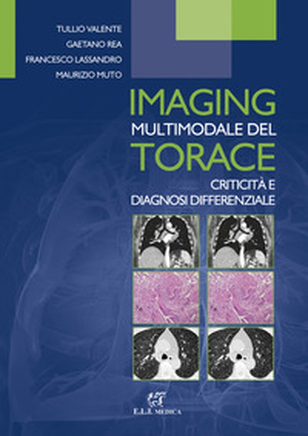 Imaging multimodale del torace. Criticità e diagnosi differenziale - Librerie.coop Imaging multimodale del torace. Criticità e diagnosi differenziale - Librerie.coop