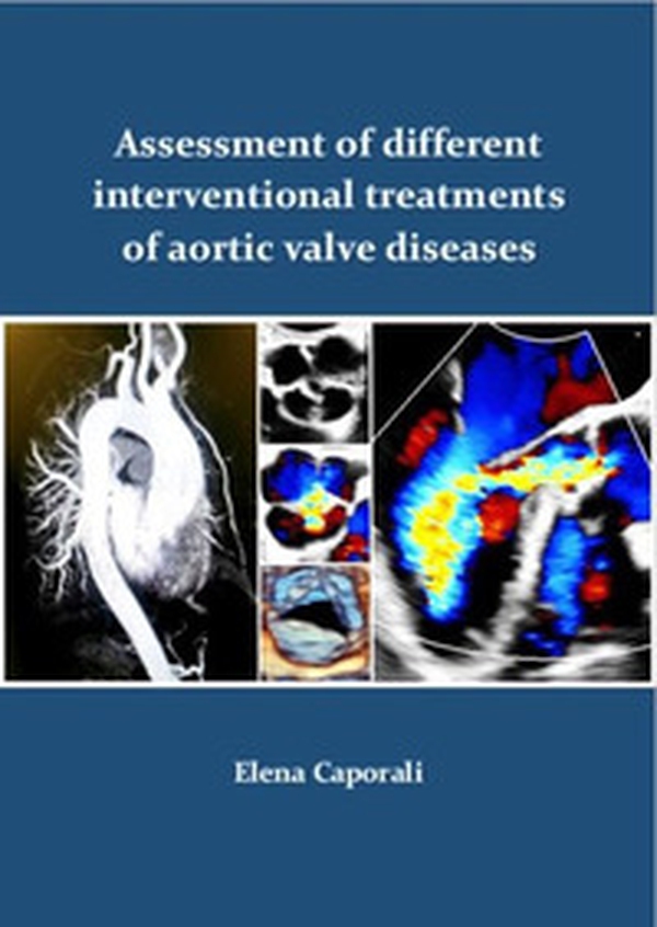 Assessment of different interventional treatments of aortic valve diseases - Librerie.coop Assessment of different interventional treatments of aortic valve diseases - Librerie.coop