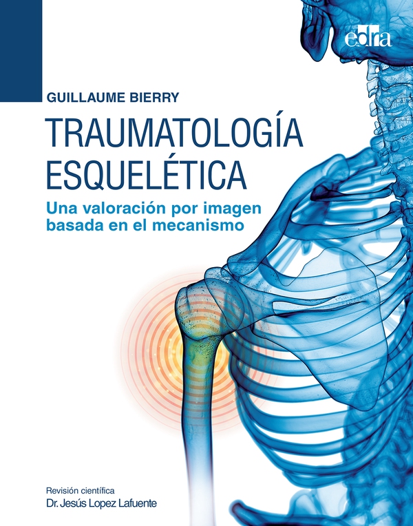 Traumatología esquelética. Una valoración por imagen basada en el mecanismo - Librerie.coop Traumatología esquelética. Una valoración por imagen basada en el mecanismo - Librerie.coop