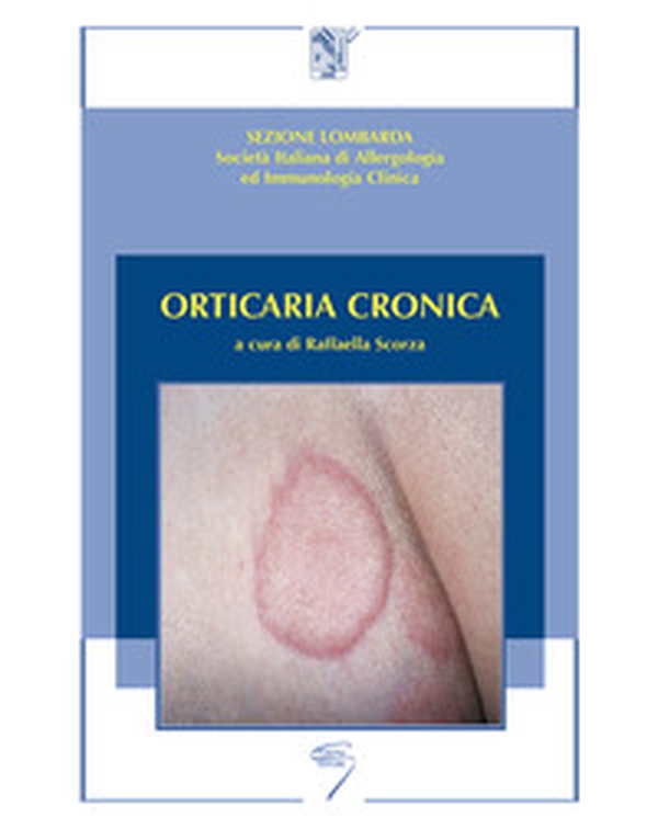 Orticaria cronica - Librerie.coop Orticaria cronica - Librerie.coop
