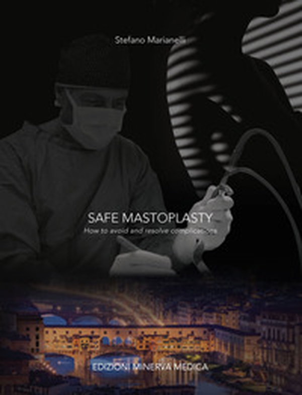 Safe mastoplasty. How to avoid and resolve complications - Librerie.coop Safe mastoplasty. How to avoid and resolve complications - Librerie.coop
