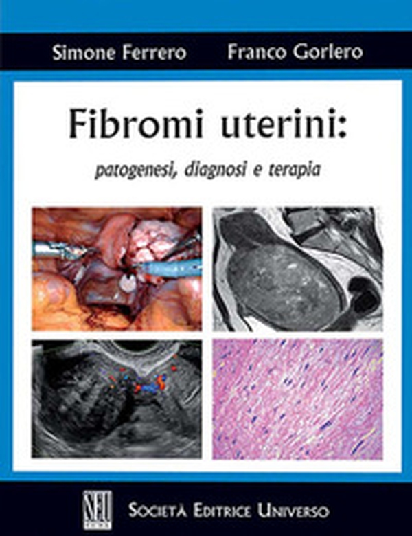 Fibromi uterini: patogenesi, diagnosi e terapia - Librerie.coop Fibromi uterini: patogenesi, diagnosi e terapia - Librerie.coop