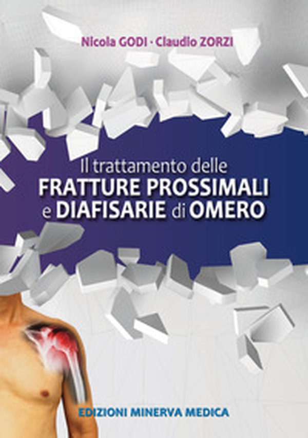 Il trattamento delle fratture prossimali diafisarie di omero - Librerie.coop Il trattamento delle fratture prossimali diafisarie di omero - Librerie.coop