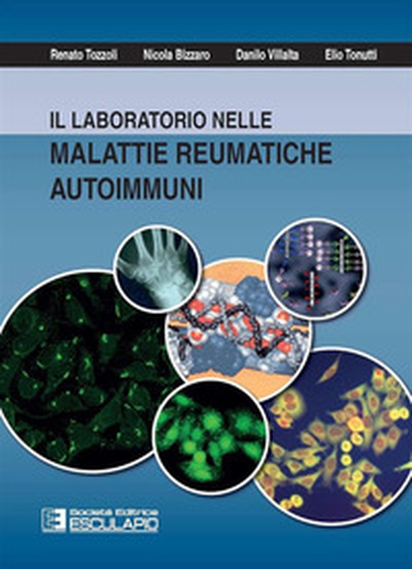 Il laboratorio nelle malattie reumatiche autoimmuni - Librerie.coop Il laboratorio nelle malattie reumatiche autoimmuni - Librerie.coop