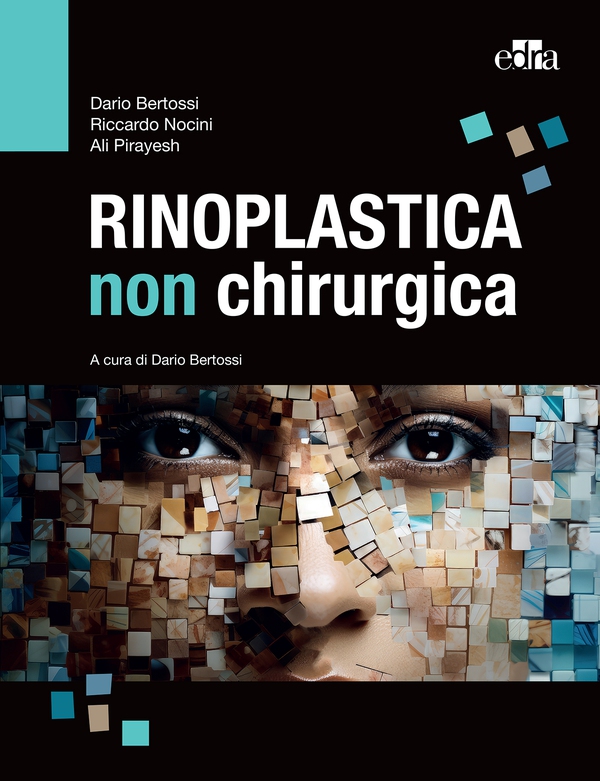 Rinoplastica non chirurgica - Librerie.coop Rinoplastica non chirurgica - Librerie.coop
