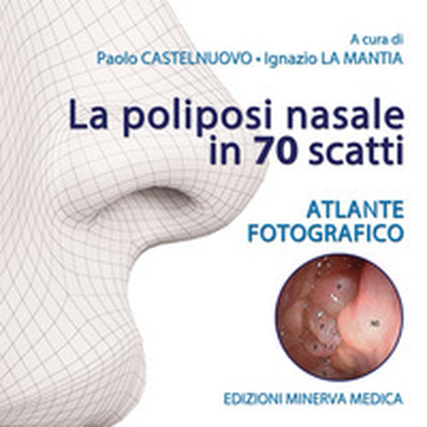 La poliposi nasale in 70 scatti. Atlante fotografico - Librerie.coop La poliposi nasale in 70 scatti. Atlante fotografico - Librerie.coop