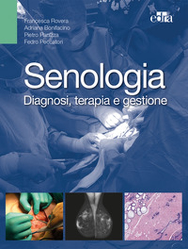 Senologia. Diagnosi, terapia e gestione - Librerie.coop Senologia. Diagnosi, terapia e gestione - Librerie.coop