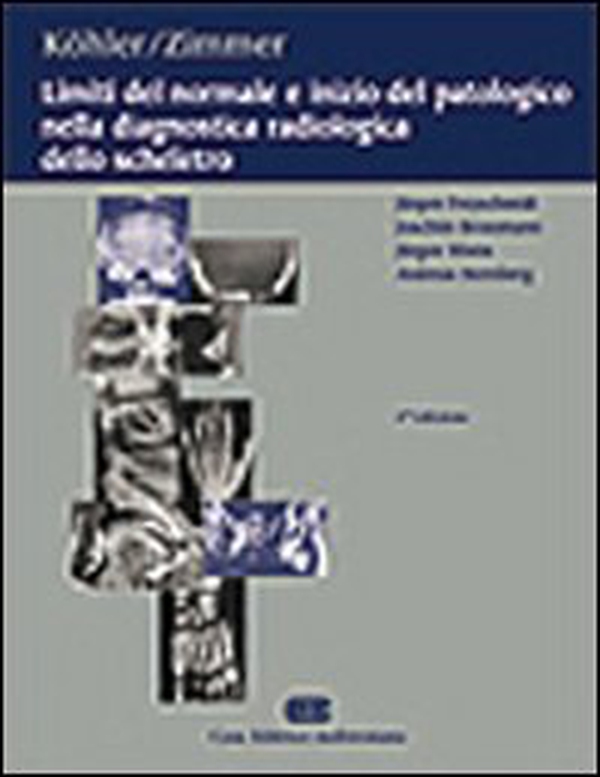 Limiti del normale e inizio del patologico nella diagnostica radiologica dello scheletro - Librerie.coop Limiti del normale e inizio del patologico nella diagnostica radiologica dello scheletro - Librerie.coop
