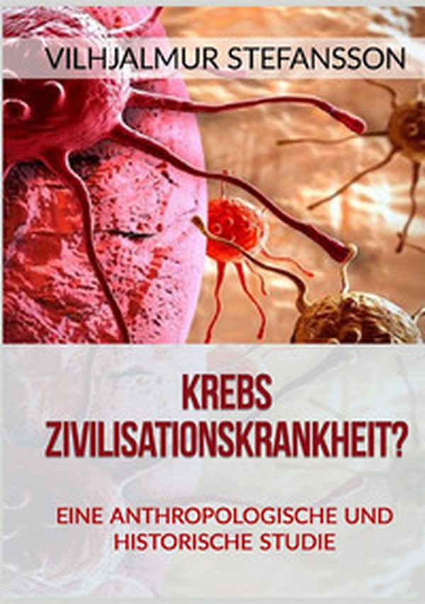 Krebs. Zivilisationskrankheit? Eine anthropologische und historische Studie - Librerie.coop Krebs. Zivilisationskrankheit? Eine anthropologische und historische Studie - Librerie.coop