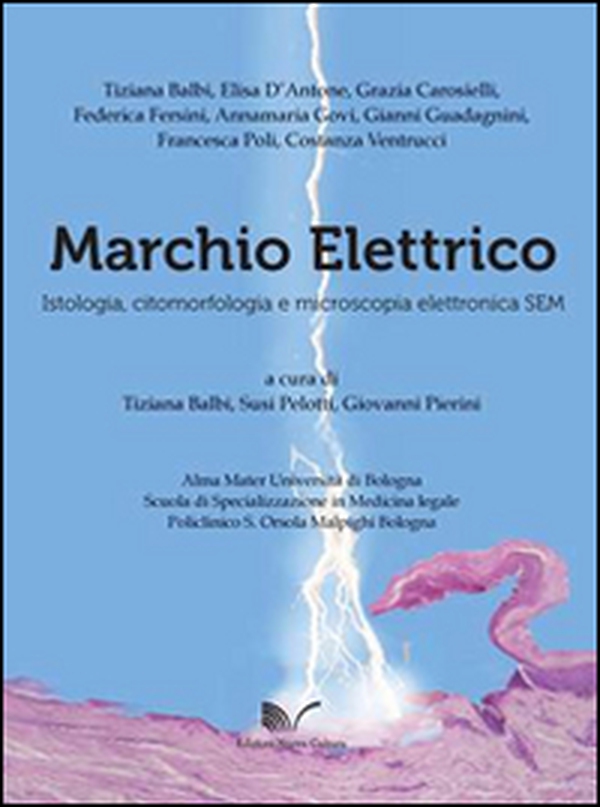 Marchio elettrico. Istologia, citomorfologia e microscopia elettronica SEM. Ediz. italiana e inglese - Librerie.coop Marchio elettrico. Istologia, citomorfologia e microscopia elettronica SEM. Ediz. italiana e inglese - Librerie.coop