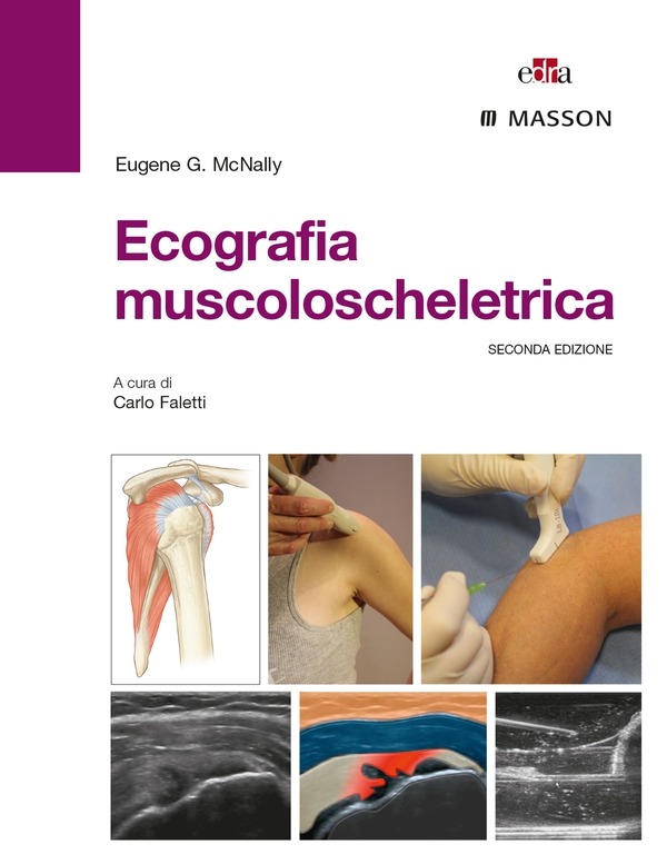 Ecografia muscoloscheletrica - Librerie.coop Ecografia muscoloscheletrica - Librerie.coop