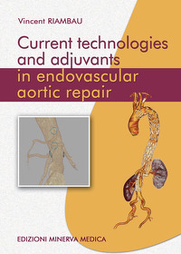 Current technologies and adjuvants in endovascular aortic repair - Librerie.coop Current technologies and adjuvants in endovascular aortic repair - Librerie.coop
