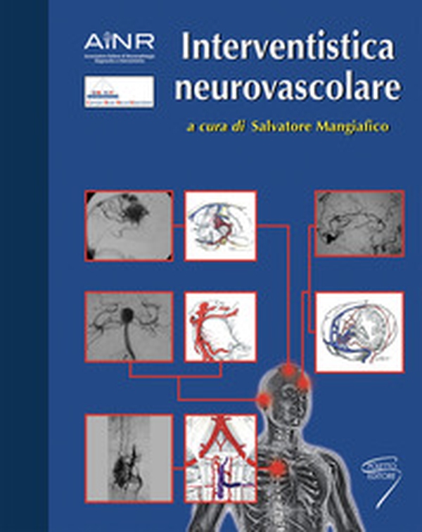 Interventistica neurovascolare - Librerie.coop Interventistica neurovascolare - Librerie.coop