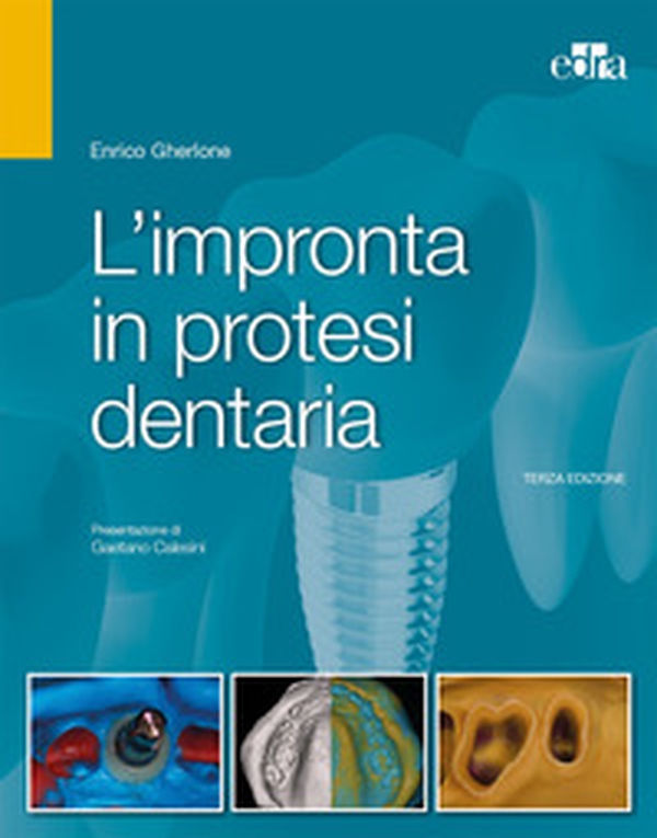 L'impronta in protesi dentaria - Librerie.coop L'impronta in protesi dentaria - Librerie.coop