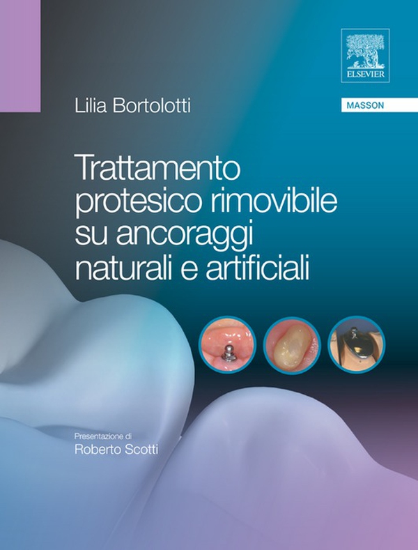 Trattamento protesico rimovibile su ancoraggi naturali e artificiali - Librerie.coop Trattamento protesico rimovibile su ancoraggi naturali e artificiali - Librerie.coop