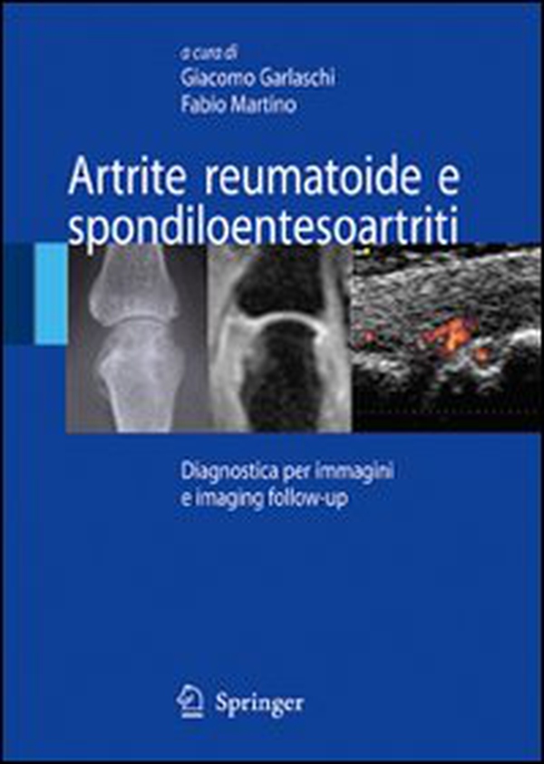 Artrite reumatoide e spondiloentesoartriti - Librerie.coop Artrite reumatoide e spondiloentesoartriti - Librerie.coop