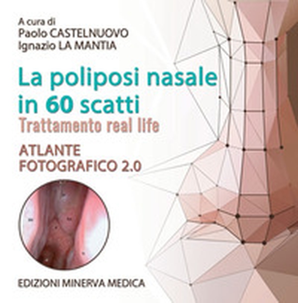 La poliposi nasale in 70 scatti. Atlante fotografico - Librerie.coop La poliposi nasale in 70 scatti. Atlante fotografico - Librerie.coop