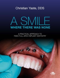 A smile where there was none. A pratical approach to fixed full-arch implant dentistry - Librerie.coop