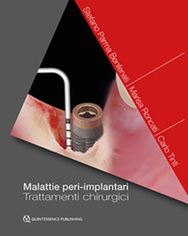 Malattie peri-implantari. Trattamenti chirurgici - Librerie.coop Malattie peri-implantari. Trattamenti chirurgici - Librerie.coop