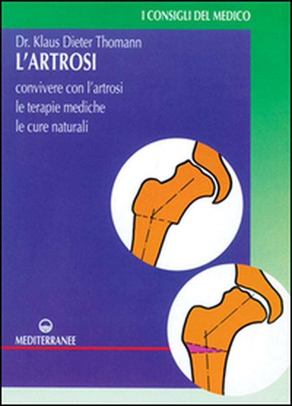 L'artrosi. Come convivere con l'artrosi. Le terapie mediche, le cure individuali - Librerie.coop L'artrosi. Come convivere con l'artrosi. Le terapie mediche, le cure individuali - Librerie.coop
