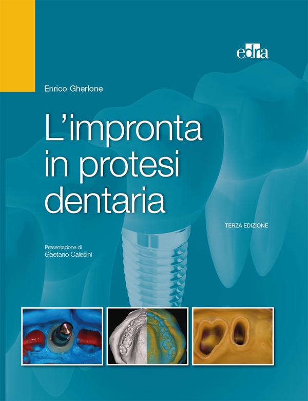 L'impronta in protesi dentaria - Librerie.coop L'impronta in protesi dentaria - Librerie.coop