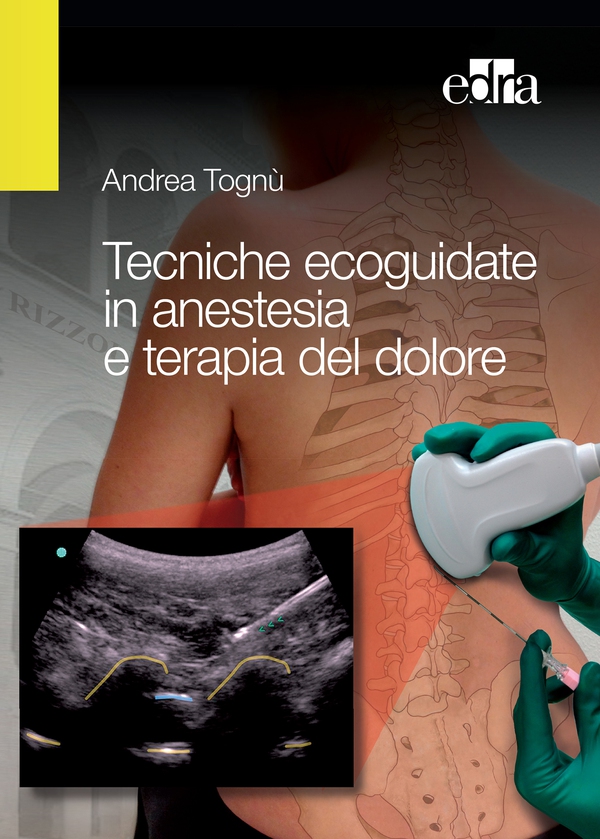 Tecniche ecoguidate in anestesia e terapia del dolore - Librerie.coop Tecniche ecoguidate in anestesia e terapia del dolore - Librerie.coop