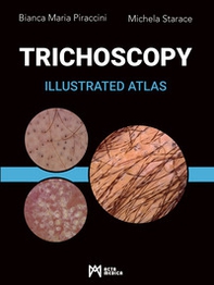 Trichoscopy. Illustrated atlas - Librerie.coop