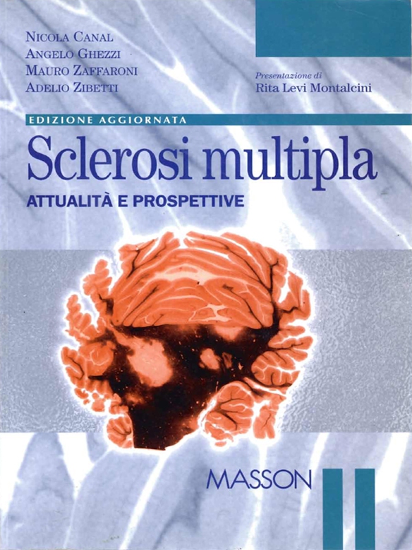 Sclerosi multipla - Librerie.coop Sclerosi multipla - Librerie.coop