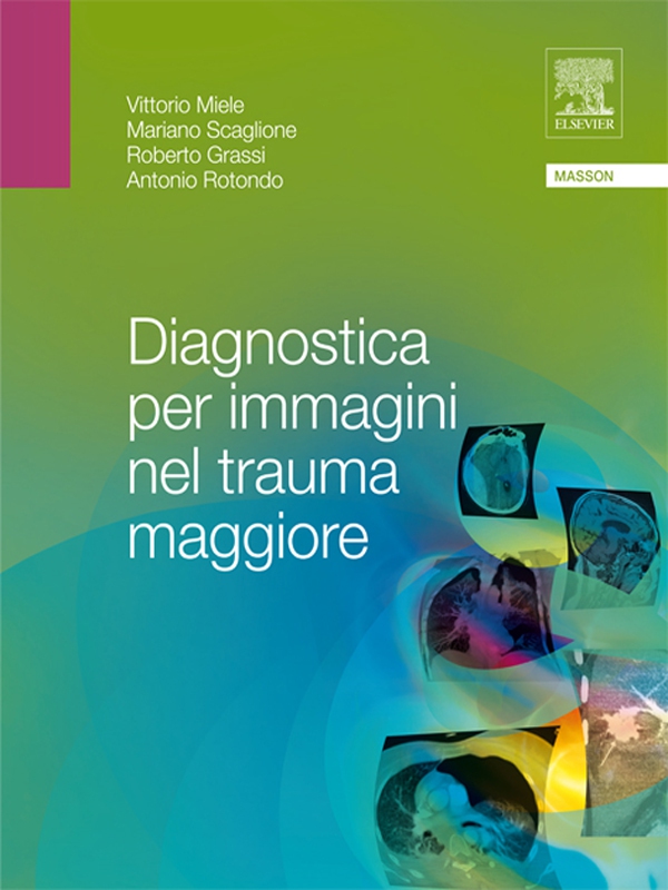 Diagnostica per immagini nel trauma maggiore - Librerie.coop Diagnostica per immagini nel trauma maggiore - Librerie.coop