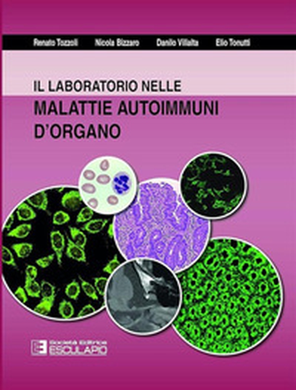 Il laboratorio nelle malattie autoimmuni d'organo - Librerie.coop Il laboratorio nelle malattie autoimmuni d'organo - Librerie.coop