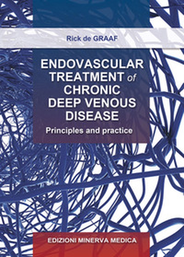 Endovascular treatment of chronic deep venous disease. Principles and practice - Librerie.coop Endovascular treatment of chronic deep venous disease. Principles and practice - Librerie.coop