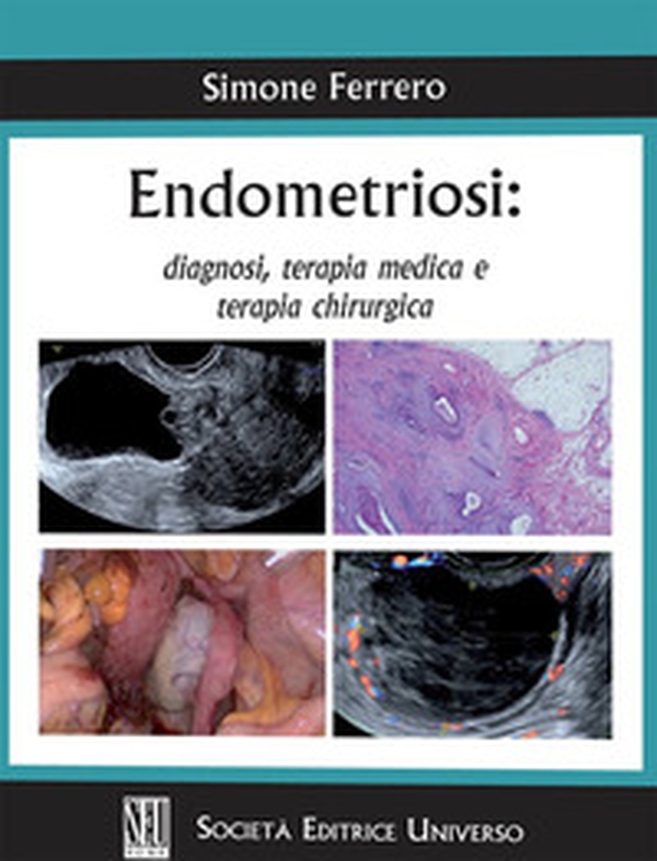 Endometriosi: diagnosi, terapia medica e terapia chirurgica - Librerie.coop Endometriosi: diagnosi, terapia medica e terapia chirurgica - Librerie.coop