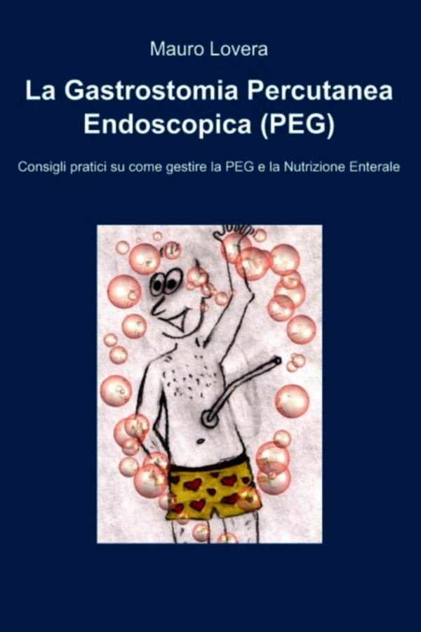 La Gastrostomia Percutanea Endoscopica (PEG) - Librerie.coop La Gastrostomia Percutanea Endoscopica (PEG) - Librerie.coop