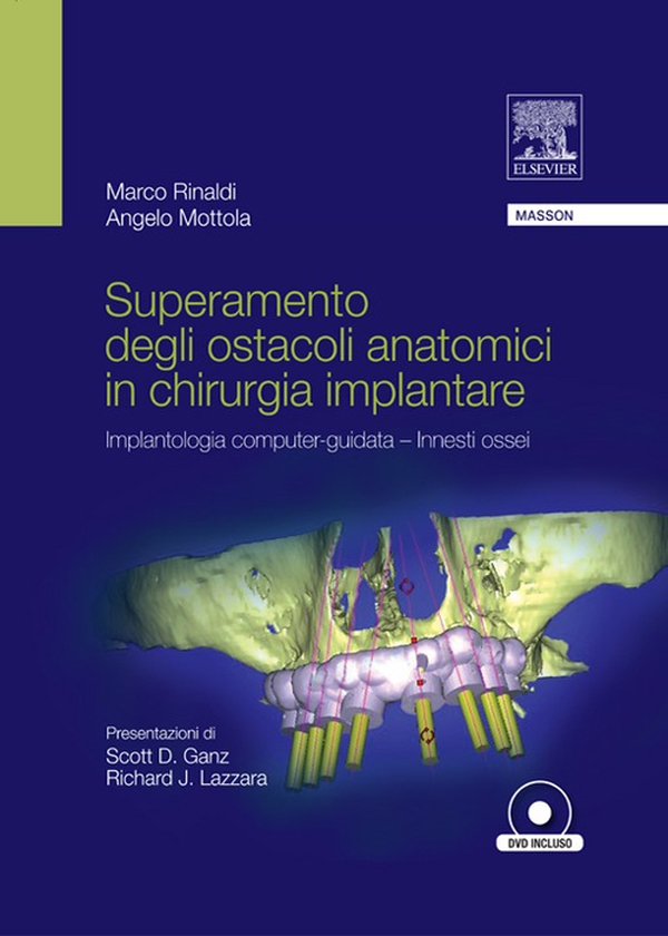 Superamento degli ostacoli anatomici in chiurgia implantare - Librerie.coop Superamento degli ostacoli anatomici in chiurgia implantare - Librerie.coop