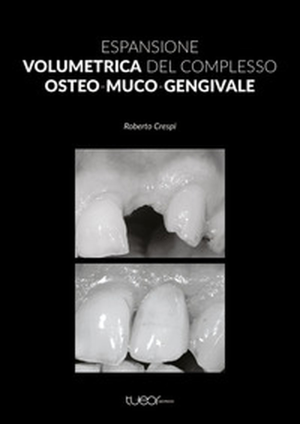 Espansione volumetrica del complesso osteo-muco-gengivale - Librerie.coop Espansione volumetrica del complesso osteo-muco-gengivale - Librerie.coop