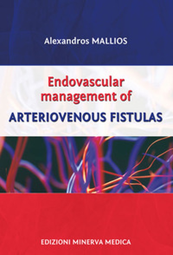 Endovascular management of arteriovenous fistulas - Librerie.coop Endovascular management of arteriovenous fistulas - Librerie.coop