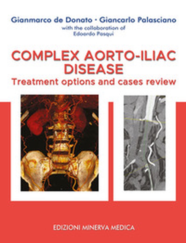 Complex aorto-iliac disease. Treatment options and cases review - Librerie.coop Complex aorto-iliac disease. Treatment options and cases review - Librerie.coop