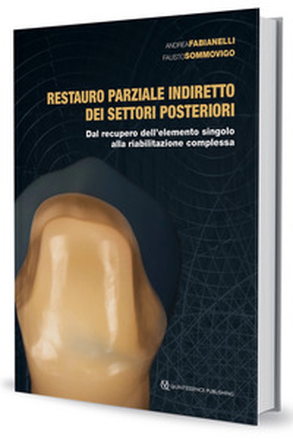 Restauro parziale indiretto dei settori posteriori. Dal recupero dell'elemento singolo alla riabilitazione complessa - Librerie.coop Restauro parziale indiretto dei settori posteriori. Dal recupero dell'elemento singolo alla riabilitazione complessa - Librerie.coop