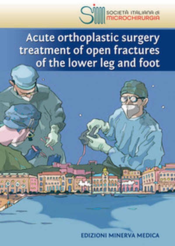 Acute orthoplastic surgery treatment of open fractures of the lower leg and foot - Librerie.coop Acute orthoplastic surgery treatment of open fractures of the lower leg and foot - Librerie.coop